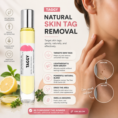 Taggy Roller Skintag Solution