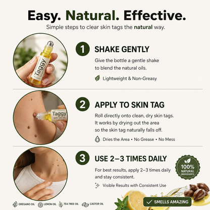 Taggy Roller Skintag Solution