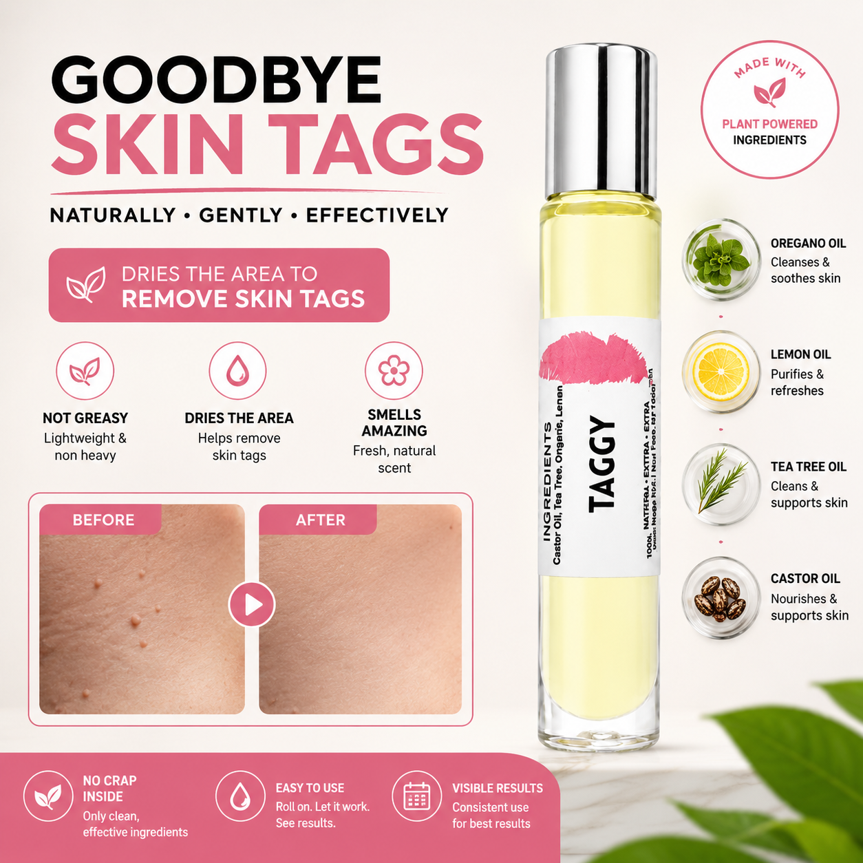 Taggy Roller Skintag Solution