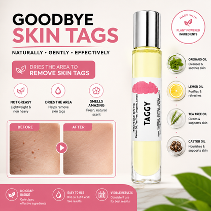 Taggy Roller Skintag Solution